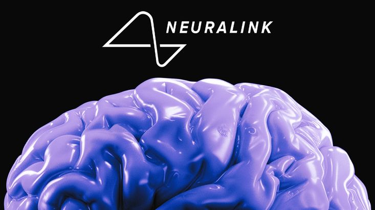 Neuralink d'Elon Musk Implante la Première Puce Cérébrale sur un Être Humain